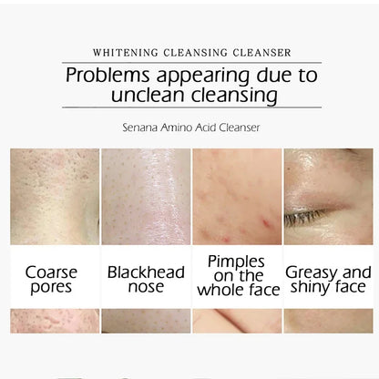 SENANA Amino Acid Face Cleanser Facial Scrub Cleansing Oil Control